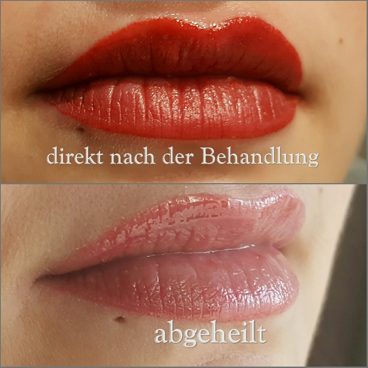 Lippen Pigmentierung Hinweise Vor Und Nach Der Behandlung